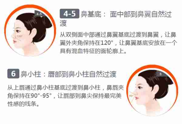 欧式挺隆鼻
