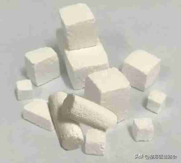 超体?超肋?舒铂?人工骨?曼特波?异体骨?肋骨?该如何选择?