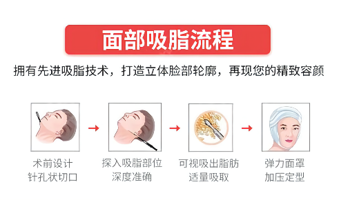 面部吸脂后应该做好哪些护理?