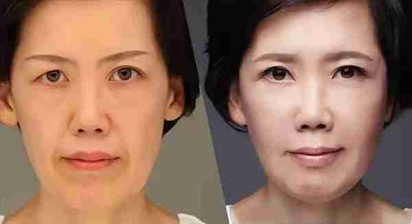 爆火的“轮廓固定”,如何花最少的钱达到最大效果,秒变“女神”