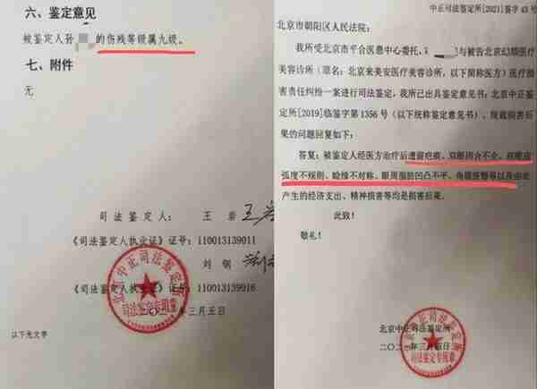 毁容、离婚、焦虑:生活崩坏在一场失败的眼整形后
