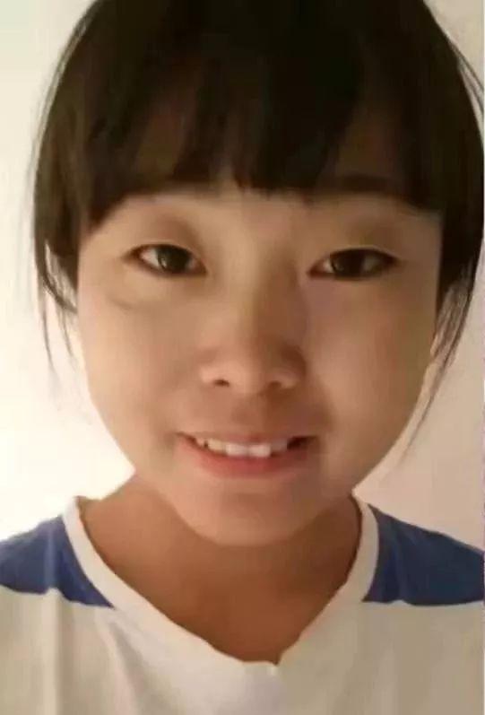 嘴突、乱牙,矫正两年之后我大变样!