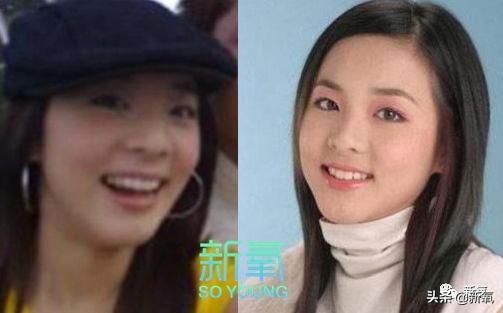 那个十年整了4次变成木偶人的女爱豆,请看看你的队友吧