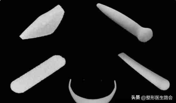 超体?超肋?舒铂?人工骨?曼特波?异体骨?肋骨?该如何选择?