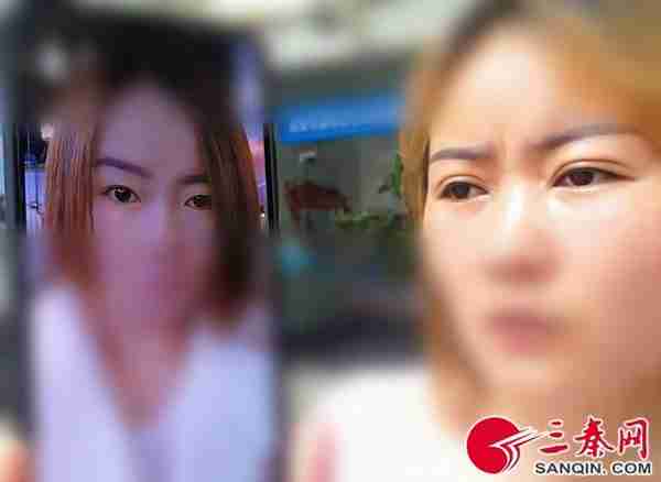 花钱美容反“毁容”双眼5个月没消肿 医疗美容师原来没资质