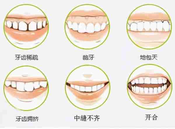 揭秘牙齿矫正“黑幕”!价格差别这么大,到底是怎么回事?